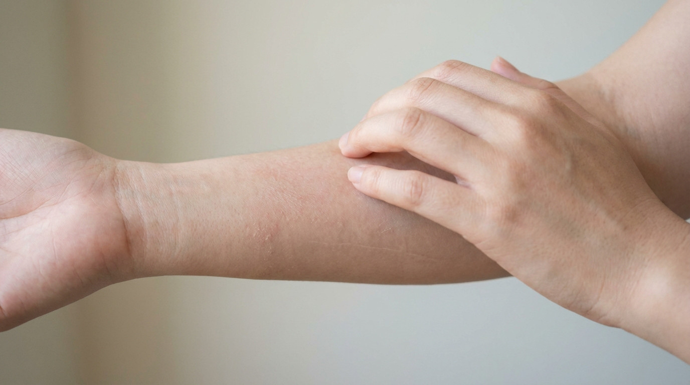 Types d'eczéma symptômes - Tout savoir sur les 6 cas - Healthy Passion
